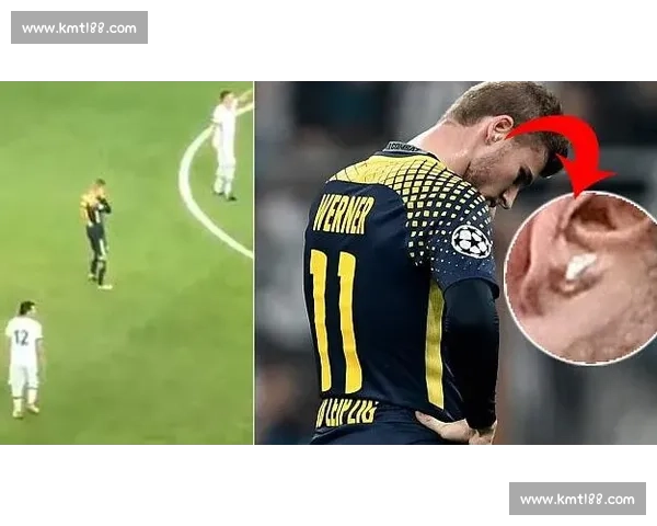 科隆主帅证实许伯斯膝伤危急 球员自知情况不妙